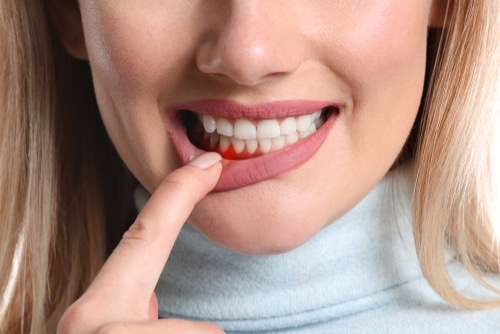 Procedimientos de odontología general para mejorar la salud de las encías