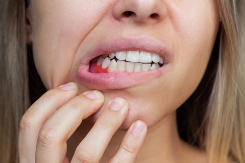 ¿Cómo puedo tener unas encías más sanas? | Happy Smiles Family Dentistry