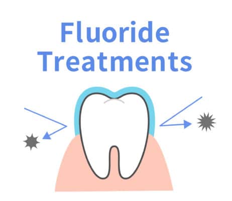 How Fluoride Is Used in General Dentistry | Happy Smiles Dentistry