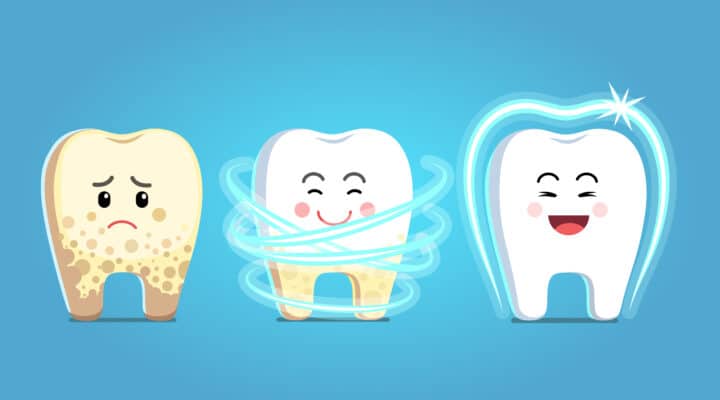 Cómo puede tratar las caries un dentista general | Sonrisas felices