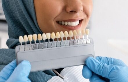 How to Care for Dental Veneers | Happy Smiles Family Dentistry