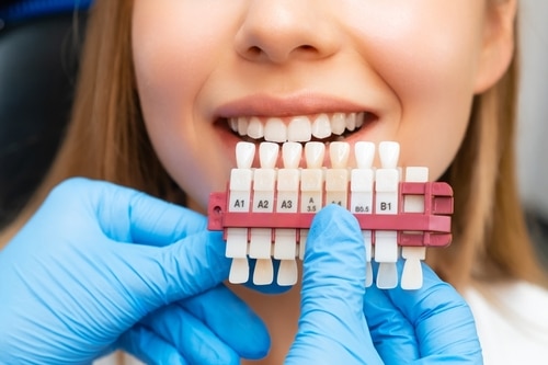 A General Dentistry Overview of Dental Veneers | Happy Smiles