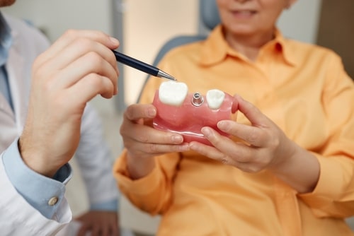 ¿Soy un candidato para los implantes dentales? | Happy Smiles Dentistry