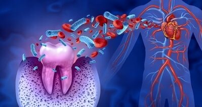 Conditions Linked to Dental Health | Happy Smiles Family Dentistry