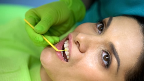 Selladores Dentales | Happy Smiles Family Dentistry | Schaumburg, IL