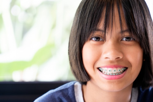 Tratamiento de ortodoncia precoz | Happy Smiles Family Dentistry