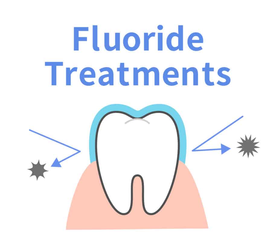 Cómo se utiliza el flúor en odontología general | Happy Smiles Dentistry