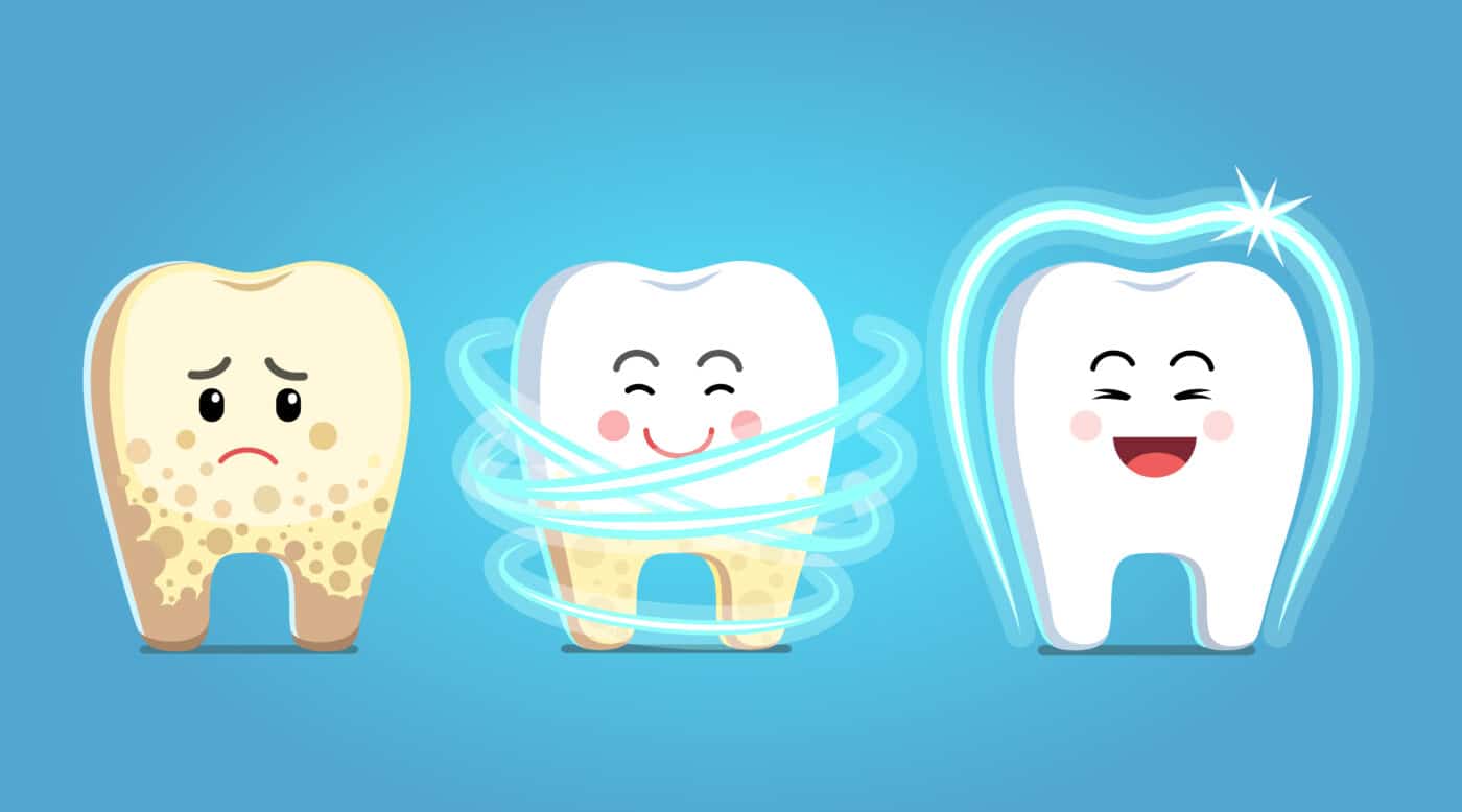 Cómo puede tratar las caries un dentista general | Sonrisas felices