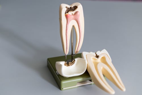 Qué es un Endodoncista Happy Smiles Family Dentistry