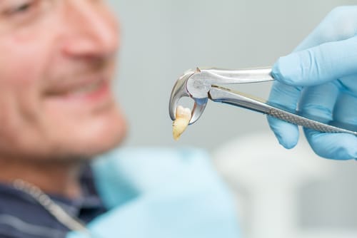 When Is a Tooth Extraction Necessary Dr. Amelia Aristodemo
