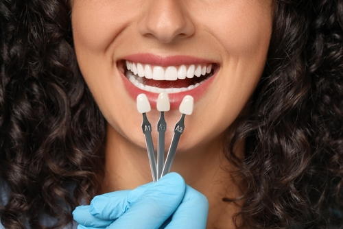 Veneers vs. Crowns in Schaumburg, IL | Enhance Your Smile Today