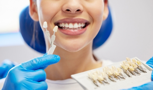 Veneers Cost in Schaumburg, IL | Invest in Your Smile Today!
