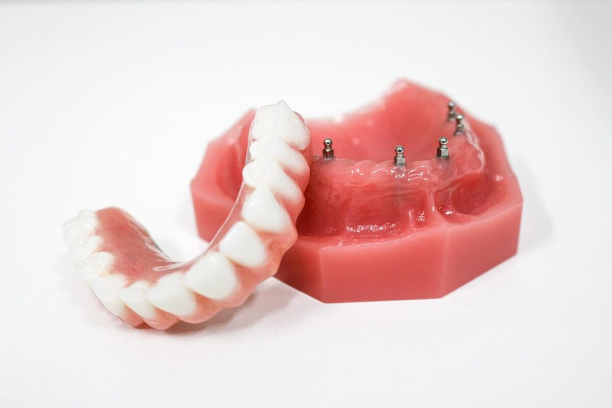 Dental Implant Denture in Schaumburg, IL | Free Consultations